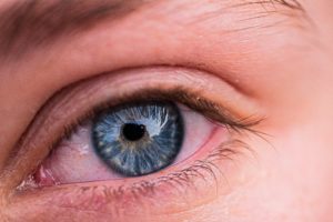 očni pritisak i druge bolesti oka o kojima malo znamo